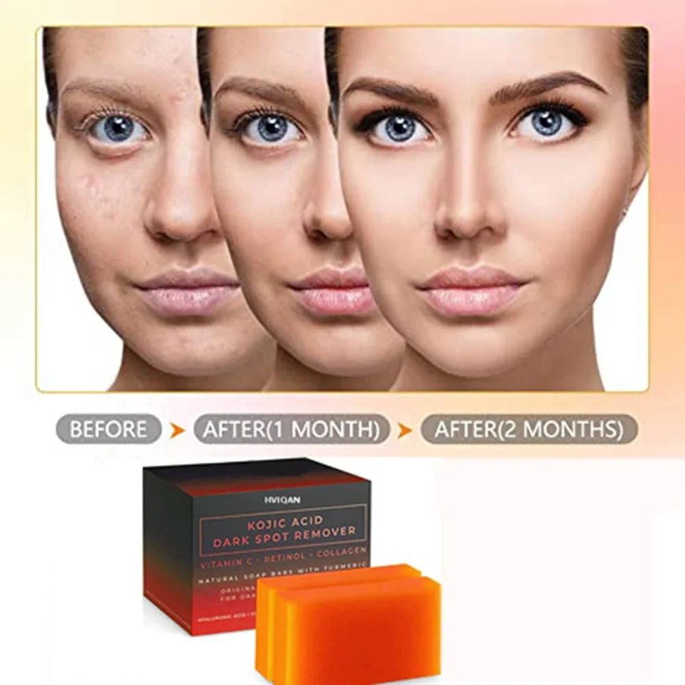 VALITIC Kojic Acid Soap Whitening Soap Remove Black Facial Soap Handmade Bleaching Acid Glycerin With Vitamin C Deep Cleaning